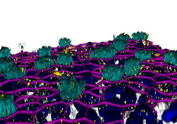 Influenza A viruses bound on primary bronchial airway epithelial cells 
